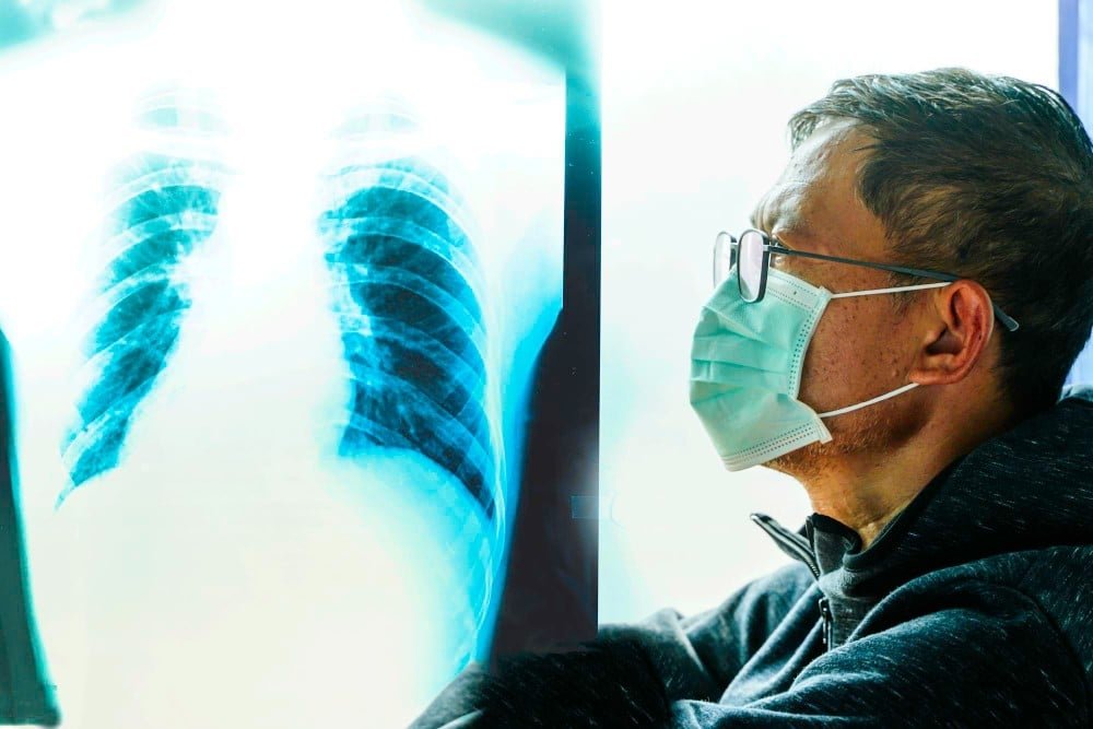 Cancer de Pulmao e Sintomas